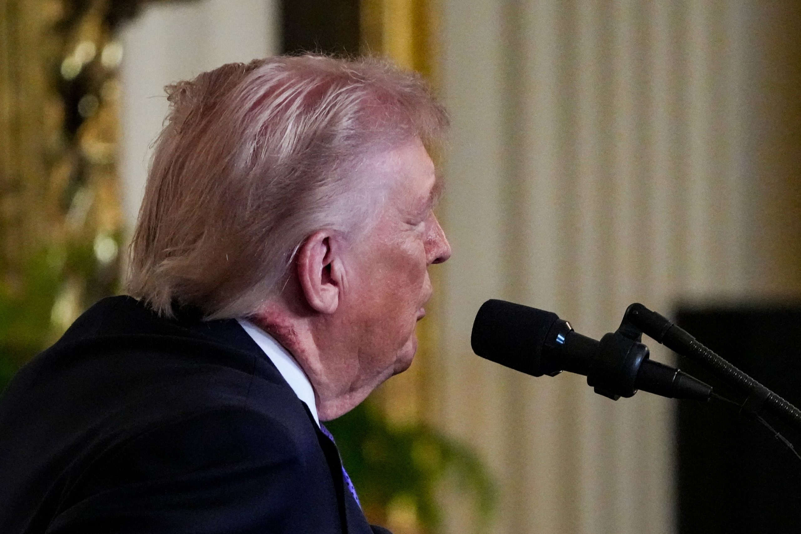 Рана или осип: Шта се то види на врату Доналда Трампа?